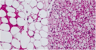 White fat cells and brown fat cells