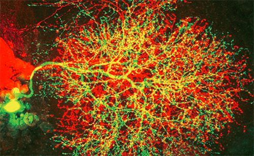 黒い背景の中に、たくさんの細い枝を持つ木のような脳の神経細胞の画像があり、枝のように見える神経の一本一本が赤や緑や黄色に着色されています