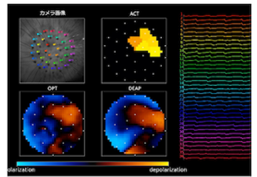 1. ECG-based Excitation Visualization AI