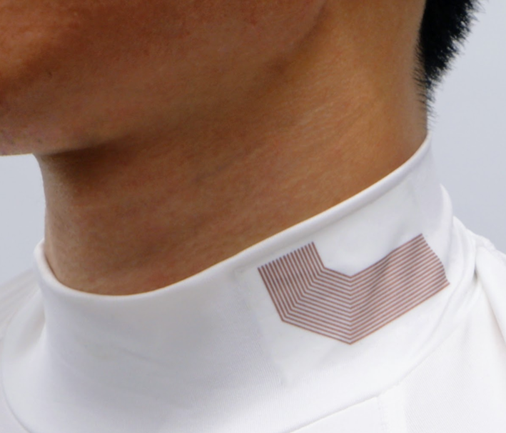 2. Flexible ultrasound probe
