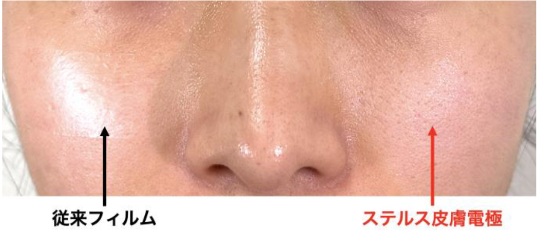 見ても触ってもわからないステルス皮膚電極
