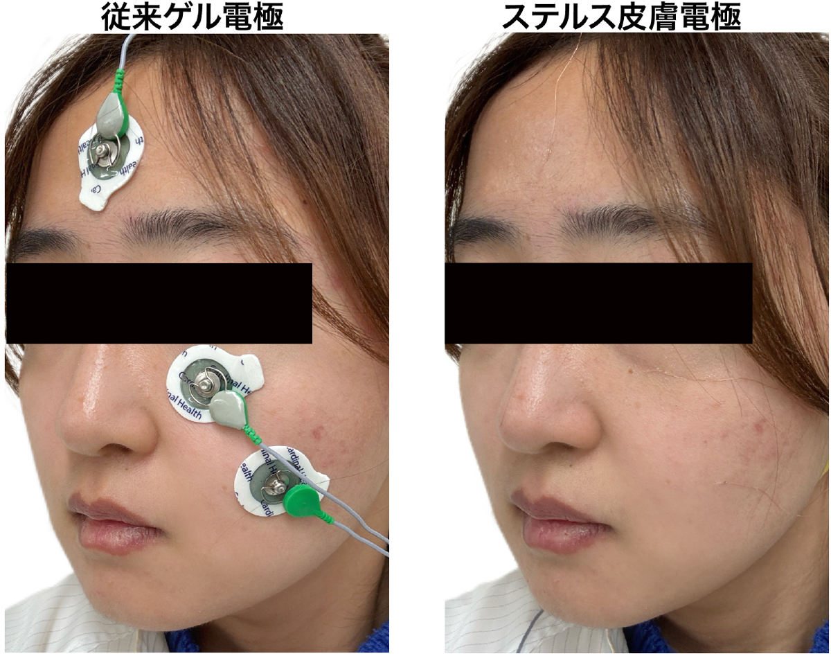 図3:顔面に多数電極を配置する様子。